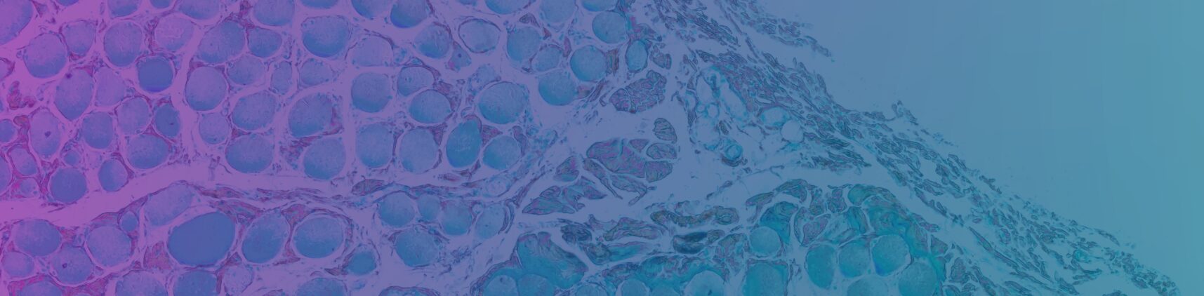 A blue and pink overlay over a close up image of a cell from a microscope slide.