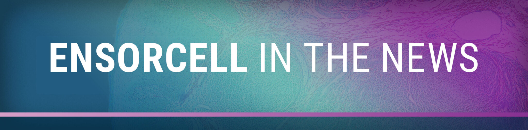 A blue, teal, pink gradient image highlights the title "Ensorcell in the news"